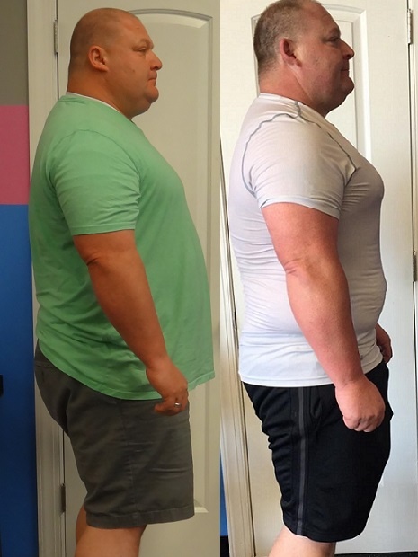 Before-and-after photos portraying successful weight loss with Glatter Fitness.