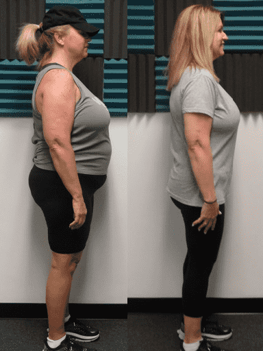 Before and after weight loss side profile of a woman at Glatter Fitness.