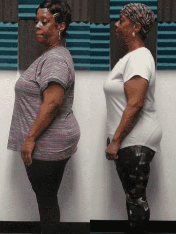 Side-by-side comparison of a woman before and after weight loss, showcasing significant improvement in her physique and posture.