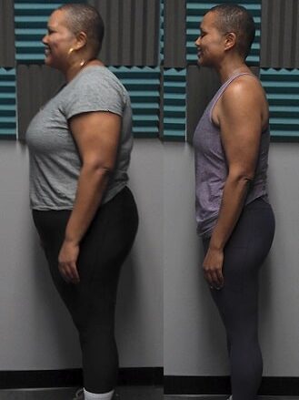 Side view before and after of a woman showing significant weight loss and improved posture